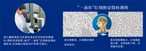 生活中哪些現(xiàn)象說明你的血液粘稠？-激光理療儀“一滴血”實(shí)驗(yàn)-康興醫(yī)療器械官網(wǎng)